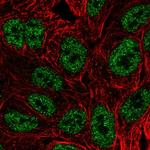 BATF Polyclonal Antibody