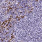 TLR7 Antibody in Immunohistochemistry (Paraffin) (IHC (P))