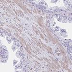 TLR7 Antibody in Immunohistochemistry (Paraffin) (IHC (P))