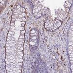 TLR7 Antibody in Immunohistochemistry (Paraffin) (IHC (P))