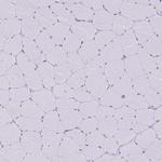 TLR7 Antibody in Immunohistochemistry (Paraffin) (IHC (P))