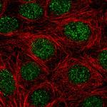 NR4A1 Polyclonal Antibody