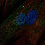 IGFBP5 Polyclonal Antibody