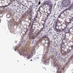 MST4 Polyclonal Antibody