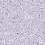 Lactoferrin Antibody in Immunohistochemistry (Paraffin) (IHC (P))