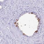 Lactoferrin Antibody in Immunohistochemistry (Paraffin) (IHC (P))