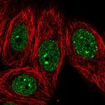 EHMT1 Polyclonal Antibody