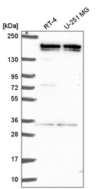 EHMT2 Antibody in Western Blot (WB)