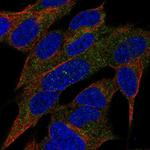 REG3A Polyclonal Antibody