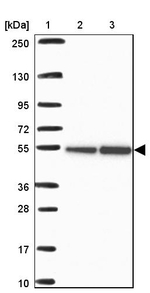 RbAp48 Antibody in Western Blot (WB)