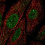 Ubinuclein 1 Polyclonal Antibody