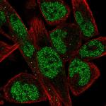 EBF1 Polyclonal Antibody