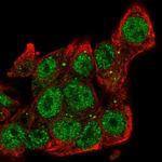 SIAH2 Polyclonal Antibody