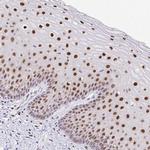 Fra2 Polyclonal Antibody