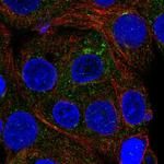 ICA1 Polyclonal Antibody