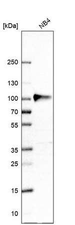 Myeloperoxidase Antibody in Western Blot (WB)