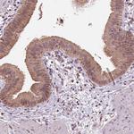 RNPEP Polyclonal Antibody