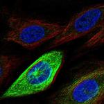 RHAMM Polyclonal Antibody