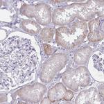 ENPP1 Antibody in Immunohistochemistry (Paraffin) (IHC (P))