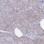 ENPP1 Antibody in Immunohistochemistry (Paraffin) (IHC (P))