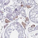 ENPP1 Antibody in Immunohistochemistry (Paraffin) (IHC (P))