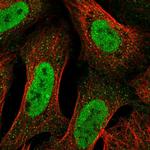 TRAK2 Polyclonal Antibody