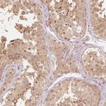 UBE2L3 Antibody in Immunohistochemistry (Paraffin) (IHC (P))