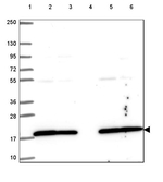 UBE2L3 Antibody in Western Blot (WB)