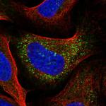 IRX3 Polyclonal Antibody