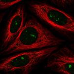 FBXW11 Polyclonal Antibody