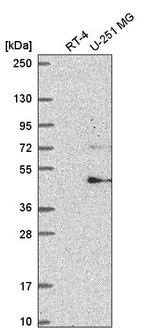 FBXW11 Antibody in Western Blot (WB)