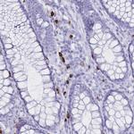CD122 Antibody in Immunohistochemistry (Paraffin) (IHC (P))