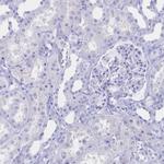 CD122 Antibody in Immunohistochemistry (Paraffin) (IHC (P))
