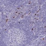 CD122 Antibody in Immunohistochemistry (Paraffin) (IHC (P))
