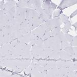 CD122 Antibody in Immunohistochemistry (Paraffin) (IHC (P))