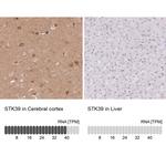 STK39 Polyclonal Antibody