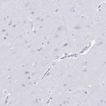 TGR5 Antibody in Immunohistochemistry (Paraffin) (IHC (P))