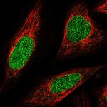 ABCA5 Polyclonal Antibody