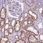 TRPV5 Polyclonal Antibody