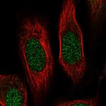 RPS19 Polyclonal Antibody