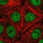 FANCA Polyclonal Antibody