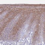 CDKN2B Polyclonal Antibody