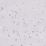 Trypsin Antibody in Immunohistochemistry (Paraffin) (IHC (P))