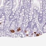 Trypsin Antibody in Immunohistochemistry (Paraffin) (IHC (P))