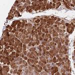 Trypsin Antibody in Immunohistochemistry (Paraffin) (IHC (P))