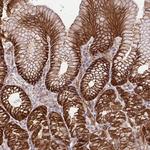 IDE Antibody in Immunohistochemistry (Paraffin) (IHC (P))