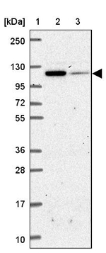 IDE Antibody in Western Blot (WB)