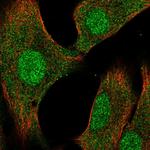 DUSP3 Antibody in Immunocytochemistry (ICC/IF)