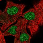 RXRB Polyclonal Antibody