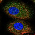 ACVR1B Polyclonal Antibody